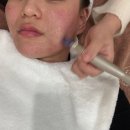 맑을린피부관리 | 광주 계림동 피부관리 찾는다면 ㅣ 맑을린에스테틱 유산균테라피 추천 후기