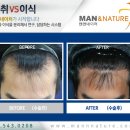맨앤네이처성형외과