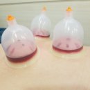 경희서동한의원 네이버블로그