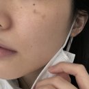 동아에스티(주) - 10267 | 함익병 미백연고 바르는 동아제약 멜라논크림 가격 기미 잡티 사용법