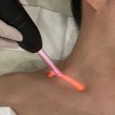 미쁘다 | 의정부신부관리 뷰티,미쁘다 승모근관리 후기