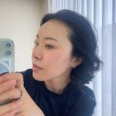 같이 | 청담동피부과 온다리프팅 얼굴탄력 초음파 와 소프웨이브 같이 한 후기
