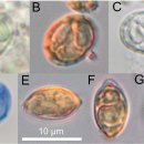 척추만곡 참돔 CNS의 Myxobolus tai와 Microsporidium 및 붉돔 신장의 M. tai 이미지