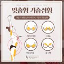 서면가슴수술후기 만족스러워요~