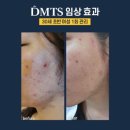 피부에봄 네이버블로그