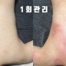 허리천사 이미지