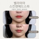 태전동피부관리 벨라마마 스킨앤헤드스파 두골비 비대칭 윤곽관리