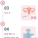 WR(대구광역시 중구)-11[달구벌대로]-하-50 | 대구차병원 pgt 검사결과 통배2개 모자이시즘2개 금액 (+자궁경후기,미세결실검사)