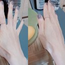 마미님들 대전 둔산동 한사랑정형외과 가서 주사 함부로 맞지마세요 ㅠㅠ 이미지