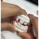 시흥시 은계 이바로치과 교정 후기