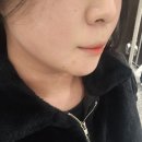 멍이랑 | 대구 동성로 얼굴 이중턱 람스 두달차 후기