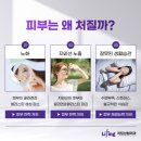 얼굴실리프팅 전후 변화 후기는