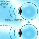 안경매니져 첨단산월점 네이버블로그