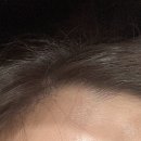 이나헤어 | 2동탄 왁싱샵 | 동탄속눈썹 이나뷰티왁싱 헤어라인 왁싱 솔직후기