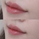 헤어온의원 | 서초동 눈썹문신 입술 반영구 자연스러운 후기