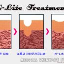 엔라이트 이미지