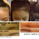 줌헤어라인