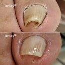 페디Bio 이미지
