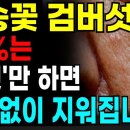 집에서 검버섯 없애는 방법 3가지 이미지