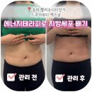 송파대로 | 송파 드로아뷰티 엑스날에서 레아쥬로 뱃살관리한 후기