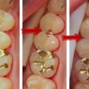 태양치과기공소 이미지