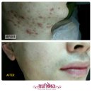 제트슬림체형피부관리실