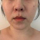 하남시미사보건센터 | 하남 미사 피부관리, 떨어진 탄력 올려준 윤곽관리 후기