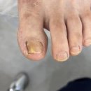 푸스케어 원주점 | 푸스케어 푸스케어 원주점 방문후기