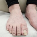 풋&네일 페디크루 무주점 | 고양내성발톱 안아프게 벗어나고 싶다면 풋네일&문제성발톱 페디크루