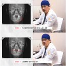 주걱턱수술 남자 턱끝 긴턱 성형 구강악안면외과치과