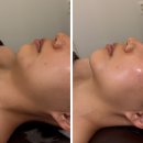 강서구-22 | 마곡 데메테르 에스테틱 | 작은 얼굴 윤곽관리 솔직 후기(22년 경력 원장님, 비대칭, 근육 뭉침 타파)