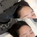 라인 | [부산두피문신, 서면두피문신 추천] <헤르민 서면점> 헤어라인 솔직후기