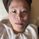 세라케어 | 구월동스킨플래닝 결 스킨케어 &lt;세라링&gt; 내돈내산 리얼후기