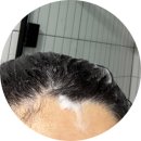 동양슈퍼문구 | 국내 무안 적양파 추출물이 들어가 탈모와 두피케어에 효과적인 프루티드 퍼플부스터 양파샴푸 후기