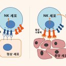 난소암 생존율, NK세포 활성화 단백질(ULBP1) 영향 크다 이미지