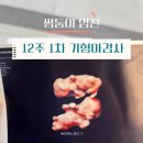 전주대학교 보건복지대학원 | 쌍둥이 임신 10~12주차 일상 | 1차 기형아검사, 정부24 맘편한 임신(교통비,ktx할인),우체국 무료보험