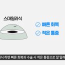 스마일 에너지(smile energy)