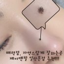 자연미인 | 백석 코끝 매력점으로 분위기 변화 ▪︎ 제이앤필 일산본점 자연스러운 미인점 리얼 후기