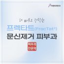 비앤씨의원 | 광진구 피부과 후회 없는 컬러 문신 제거 방법은