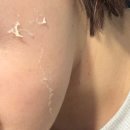 (주)프로바이오닉 | 의정부 피부관리, 뉴알라딘필링 &#34;스킨스토리&#34; 2차(재생관리)