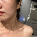 엘라 | 강남에스테틱 뷰티더엘라 페이스관리 후기