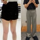 강남다이어트병원 지방분해주사 허벅지다이어트 3회차 후기