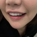 체리스마일치과의원 이미지