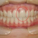 엘리트치과기공소 이미지