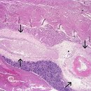 세균성 부레이상 [Swim Bladder Disorder] 이미지