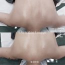 오운스킨라운지 | [웨딩관리ᰔ내돈내산]강남 언주역 신부피부관리 오운스킨라운지