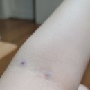 서울맑음내과의원 네이버블로그