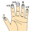 뜸 이미지