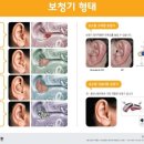 착한보청기 이미지