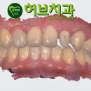 허브치과기공소 티스토리